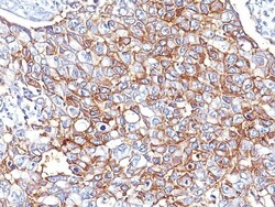 EpCAM/TROP1 Antibody (PAN-EpCAM (Cocktail)), Novus Biologicals 0.2mg; Unlabeled:Antibodies,